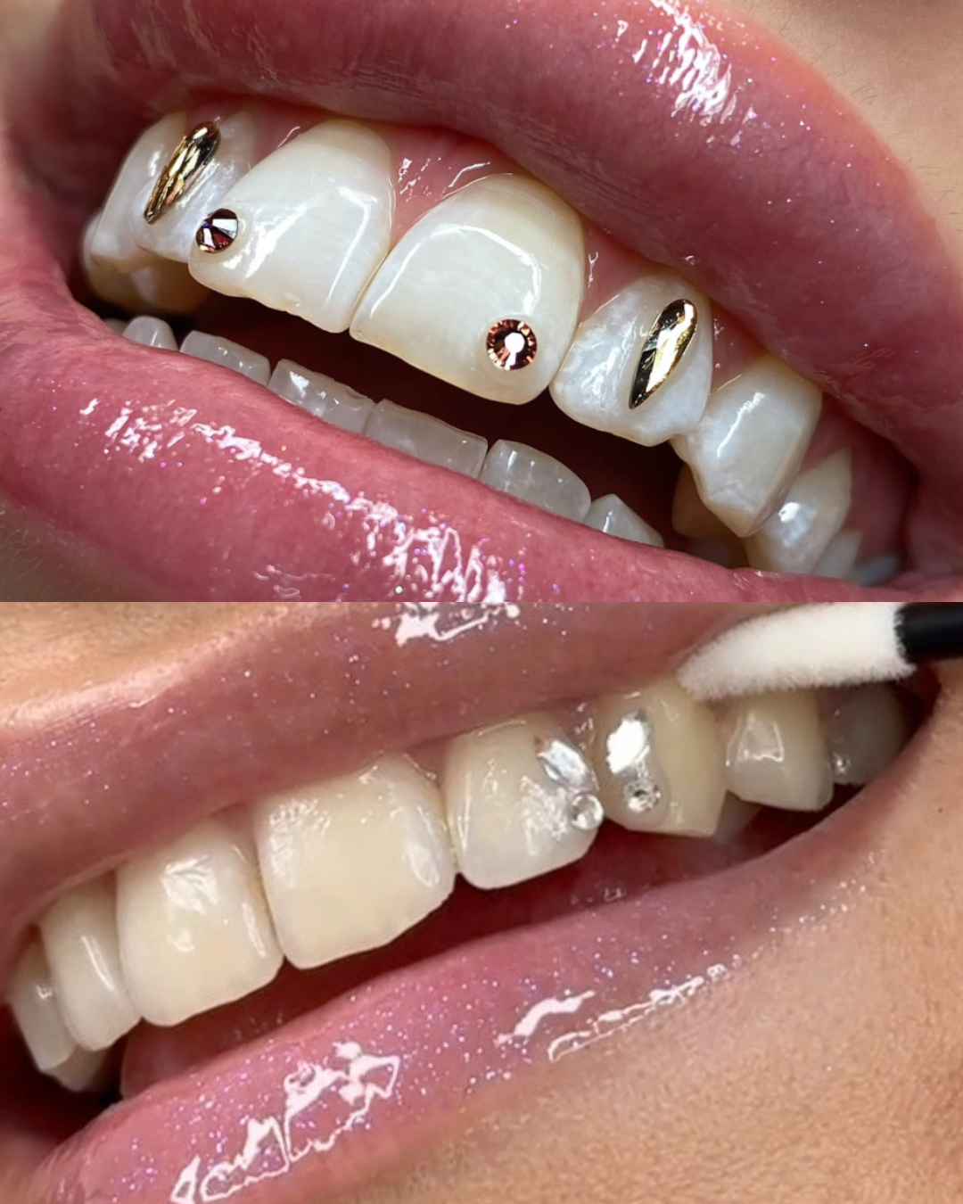 ZAHNSCHMUCK & BLEACHING